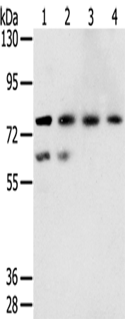 兔抗TMPRSS7多克隆抗体 
