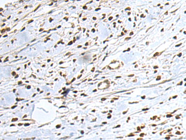 小鼠抗MICU1单克隆抗体   