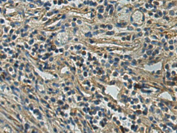 兔抗TNFRSF10A多克隆抗体 