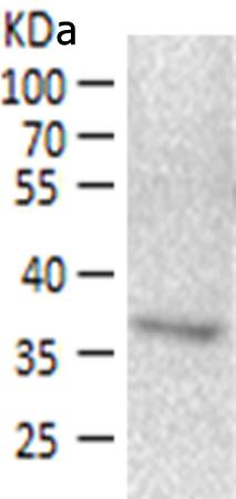 小鼠抗MTHFD2单克隆抗体 