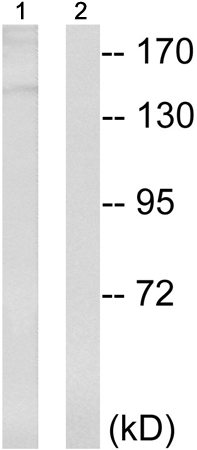 兔抗TOP2A(Phospho-Thr1343) 多克隆抗体