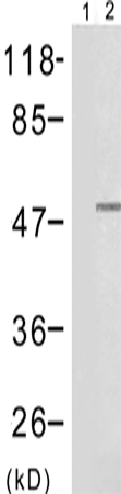 兔抗TP53 (Phospho-Ser15)多克隆抗体