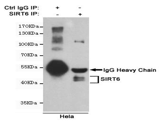 小鼠抗SIRT6单克隆抗体   