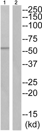 兔抗TPH2(Phospho-Ser19) 多克隆抗体