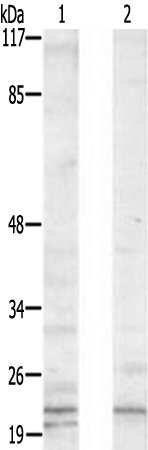 兔抗TRAPPC3多克隆抗体 