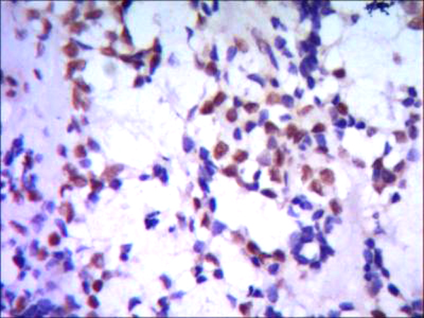 小鼠抗TBL1XR1单克隆抗体