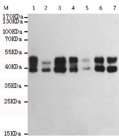 小鼠抗TNFRSF10B单克隆抗体
