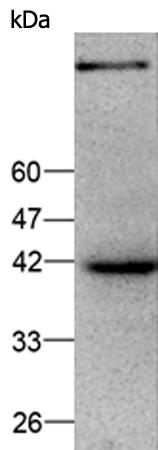 小鼠抗ZSCAN22单克隆抗体