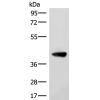 兔抗ST8SIA4多克隆抗体