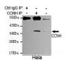小鼠抗CCNH单克隆抗体   