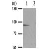 兔抗STAT5A/B(Phospho-Ser725/730) 多克隆抗体