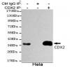 小鼠抗CDX2单克隆抗体  
