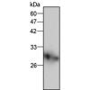 小鼠抗CSNK2B单克隆抗体  