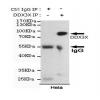 小鼠抗DDX3X单克隆抗体 
