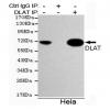 小鼠抗DLAT单克隆抗体   