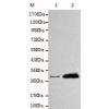 小鼠抗DOK7单克隆抗体 