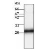 小鼠抗FHL2单克隆抗体  