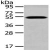 兔抗TCN2多克隆抗体