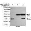小鼠抗PCNA单克隆抗体   