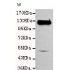 小鼠抗PECAM1单克隆抗体 