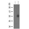 兔抗TH (Phospho-Ser31)多克隆抗体