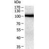 小鼠抗HSP90B1单克隆抗体  