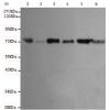 小鼠抗IGF2BP3单克隆抗体  