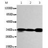小鼠抗PPP1CA单克隆抗体