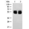 小鼠抗KRT8单克隆抗体 