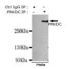 小鼠抗PRKDC单克隆抗体 