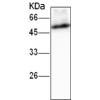 小鼠抗PSMD4单克隆抗体 