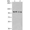 兔抗TMEM67多克隆抗体