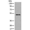 兔抗TMEM121B多克隆抗体