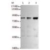小鼠抗MLH1单克隆抗体  