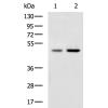 兔抗TNFRSF10A多克隆抗体 
