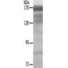 兔抗TOP2A(Ab-1343) 多克隆抗体