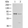 兔抗TP63多克隆抗体