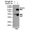 小鼠抗STAT1单克隆抗体   