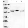 小鼠抗TBL1XR1单克隆抗体