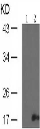 兔抗SNCA (Phospho-Tyr136)多克隆抗体