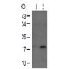 兔抗STMN1 (Phospho-Ser16)多克隆抗体