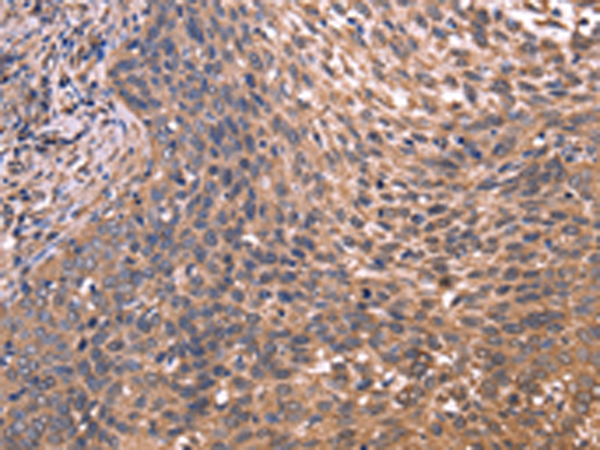 兔抗GCG(GLP1)多克隆抗体