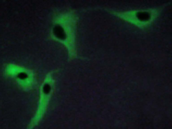 兔抗TSPAN8多克隆抗体