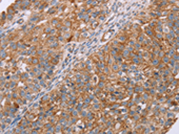 兔抗RMDN3多克隆抗体