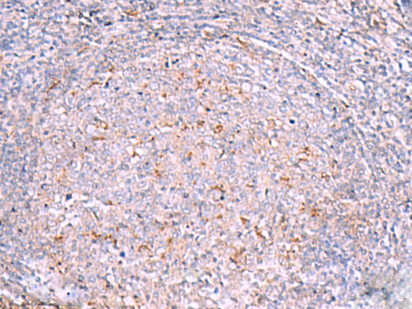 兔抗RNF217多克隆抗体