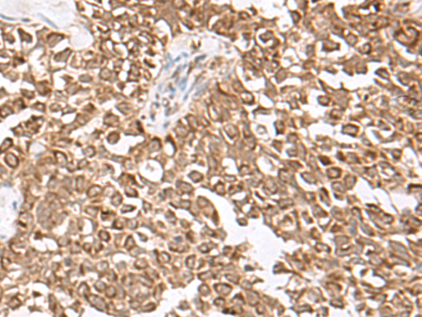 兔抗USP16多克隆抗体  