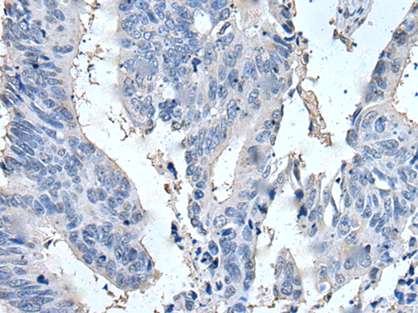 兔抗SCGB2A1多克隆抗体