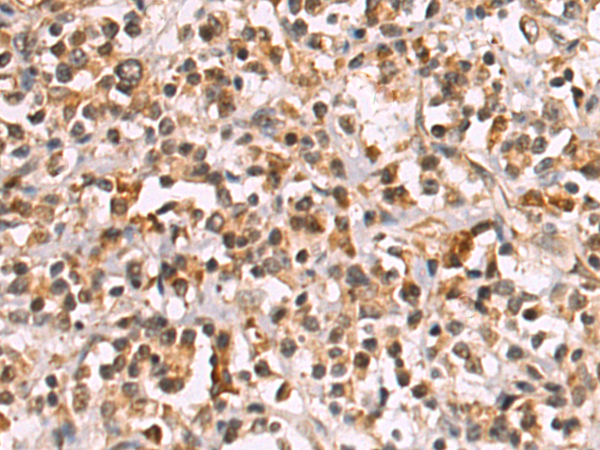 兔抗SLC29A2多克隆抗体