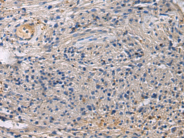 兔抗SLC30A3多克隆抗体