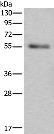  兔抗SLC38A1多克隆抗体